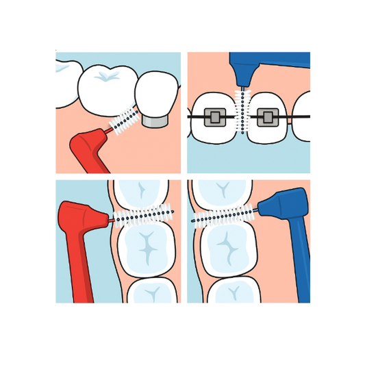 How to use interdental brushes - 4 step guide