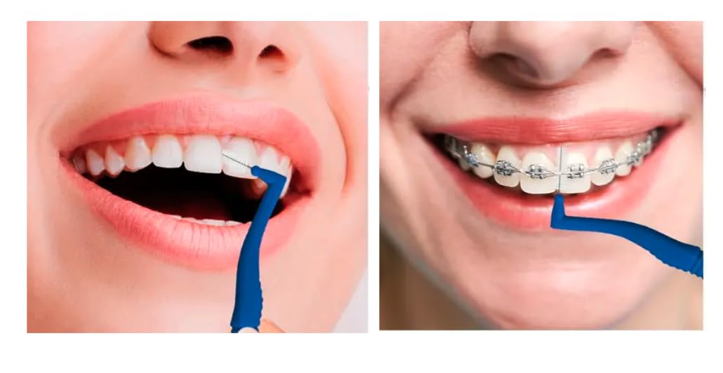 Angle Interdental Brush — Blue 0.6mm
