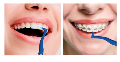 Angle Interdental Brush — Blue 0.6mm