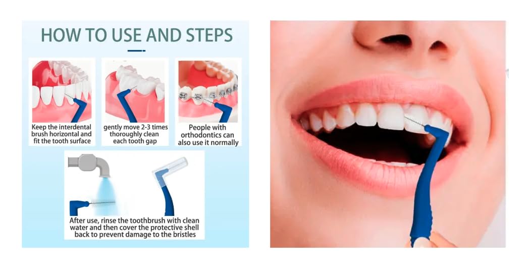 Angle Interdental Brush — Blue 0.6mm