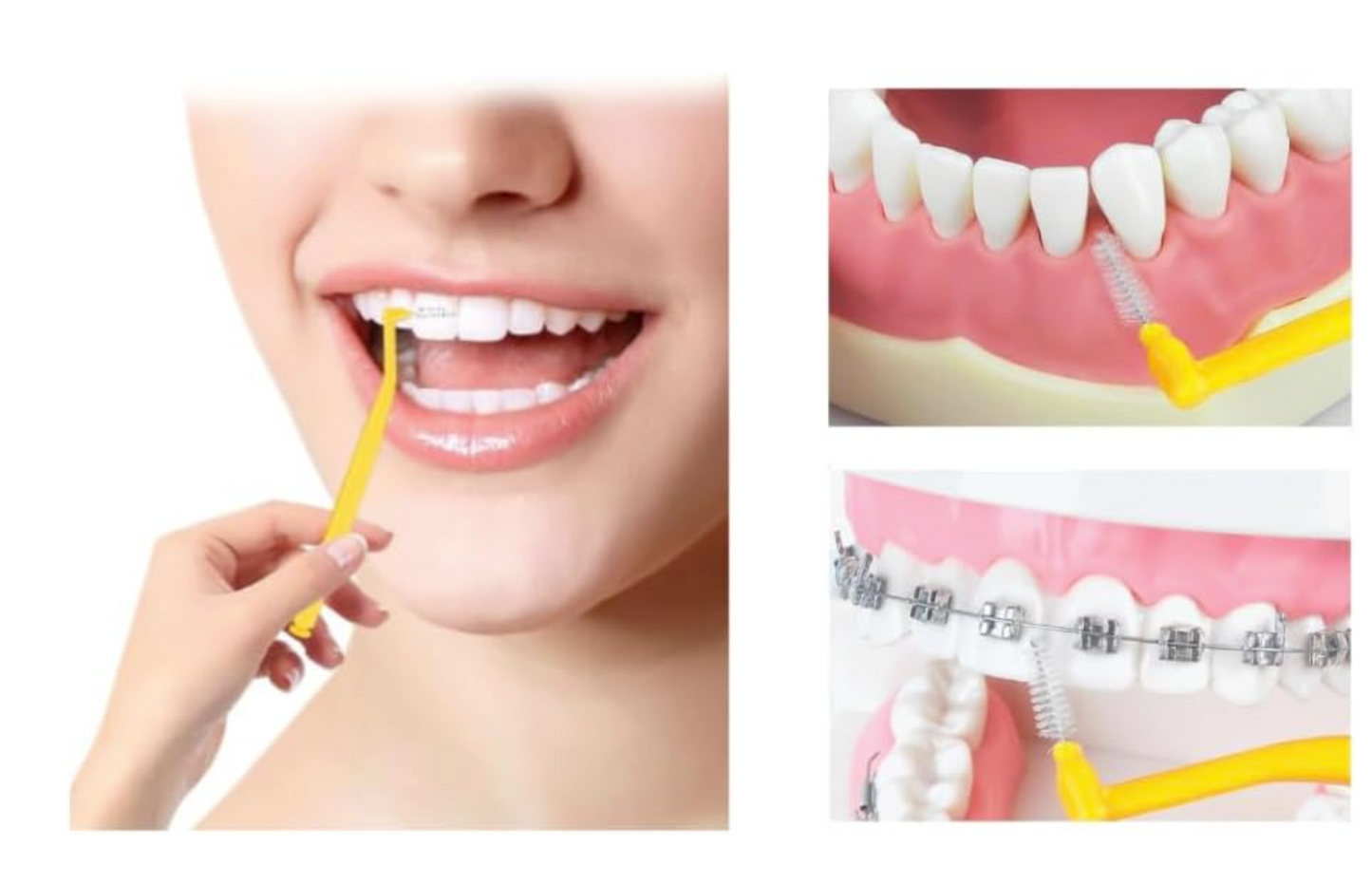 Sanitral ‘Angle’ Yellow Interdental Brush +0.45mm